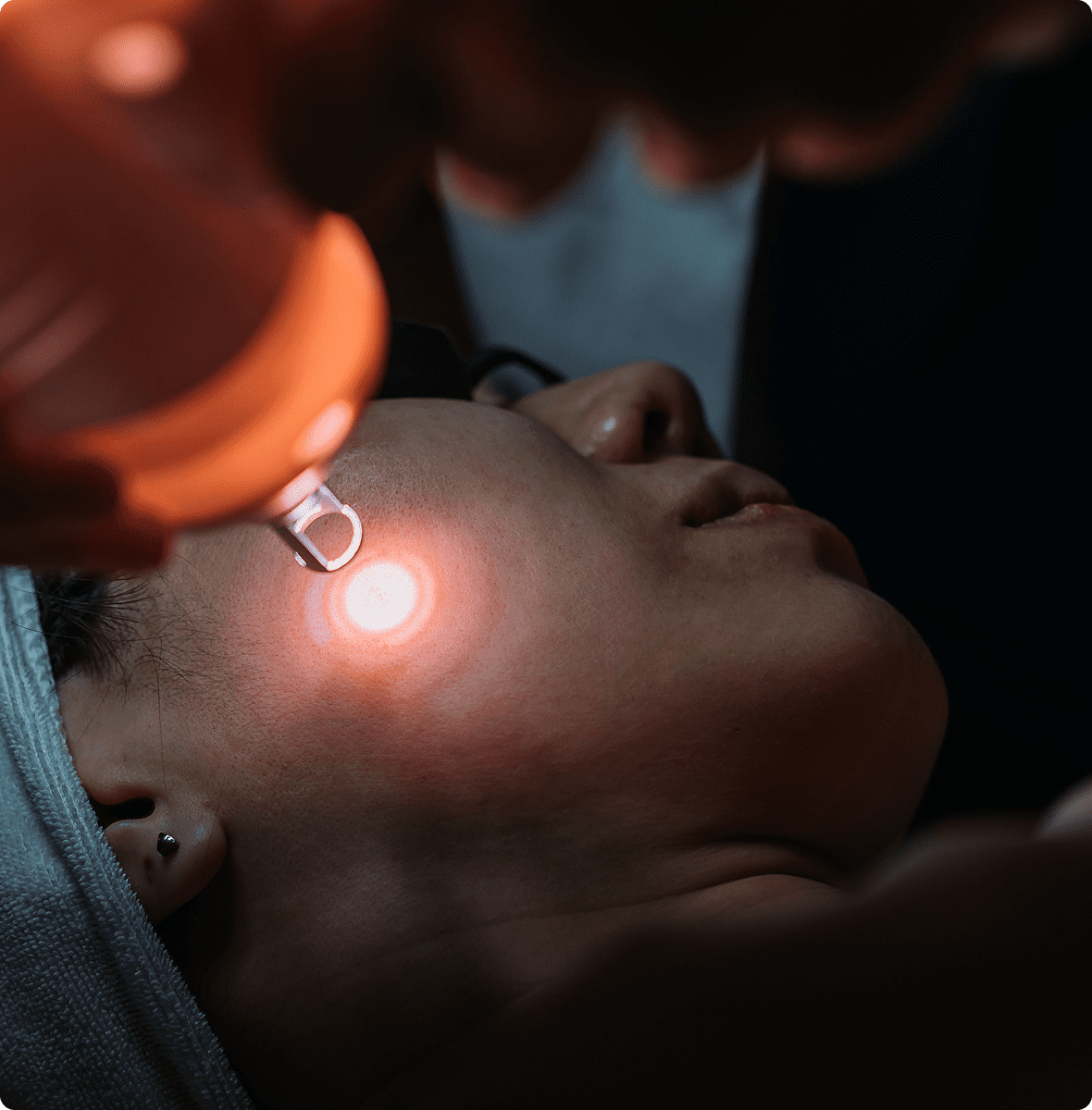Close-up of laser skin procedure