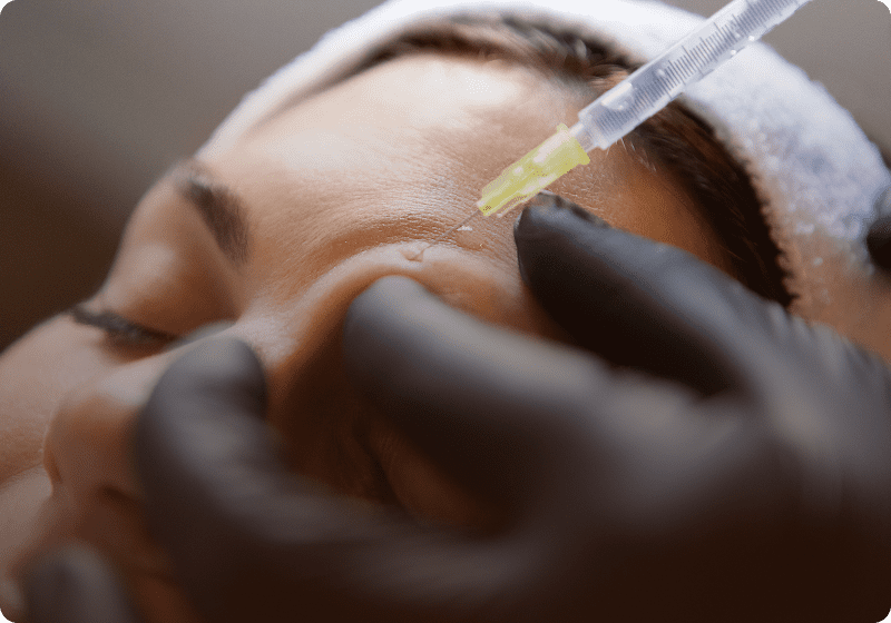 Beauty treatment with syringe
