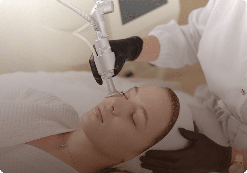 Facial treatment using laser technology
